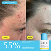 ZIIP Clear Sérum + Acide Salicylique