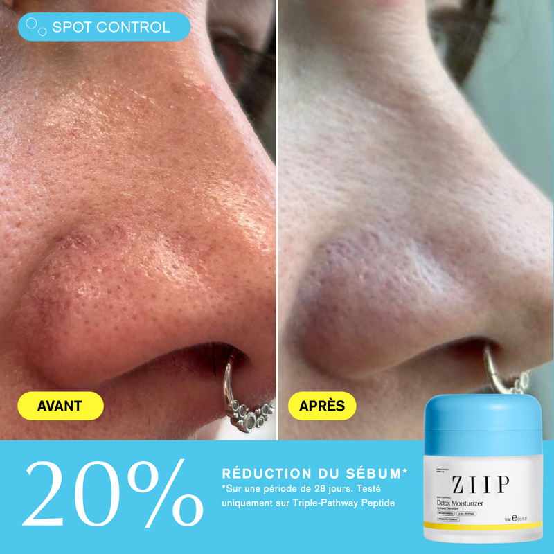 ZIIP Detox Crème + Niacinamide