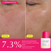 ZIIP Refresh Sérum + Acide Tranexamique