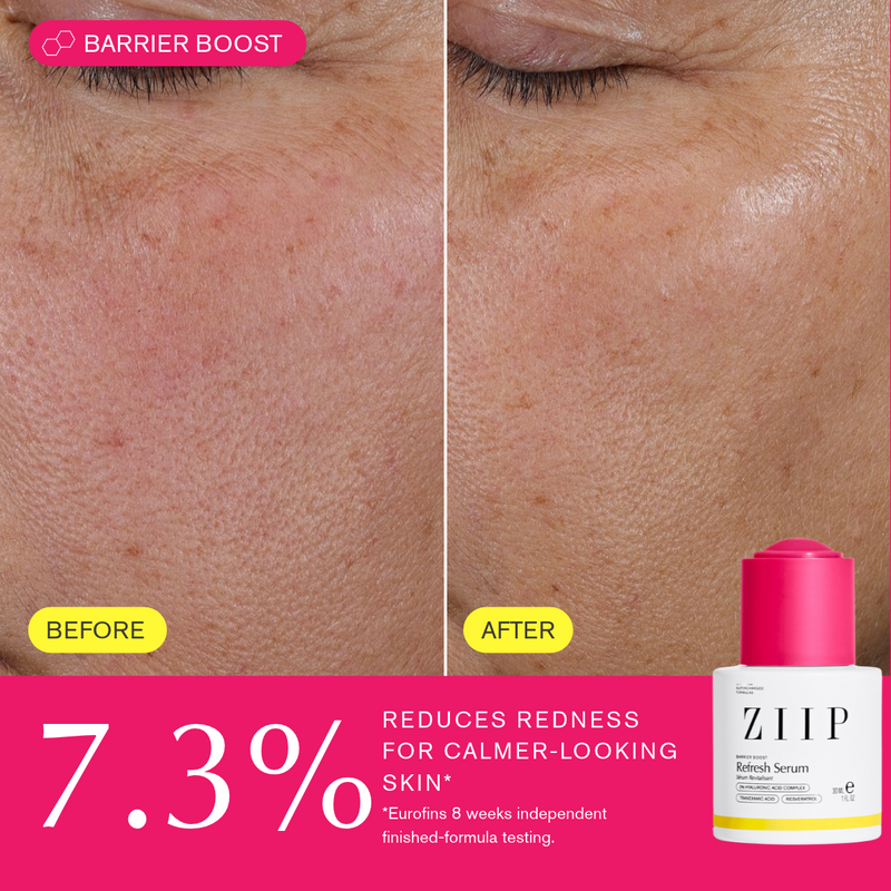 ZIIP Refresh Sérum + Acide Tranexamique