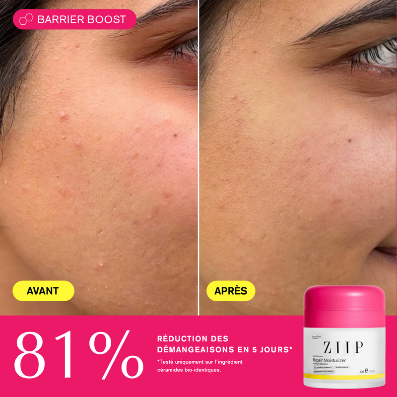 ZIIP Repair Crème + Céramides